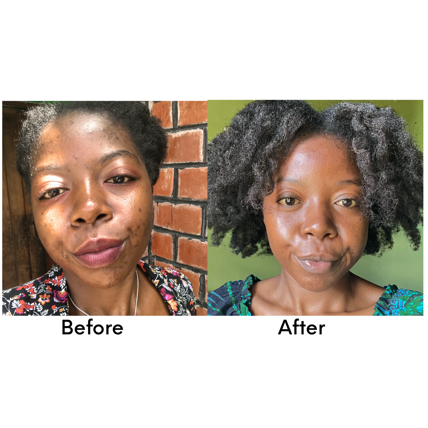 Face Serum